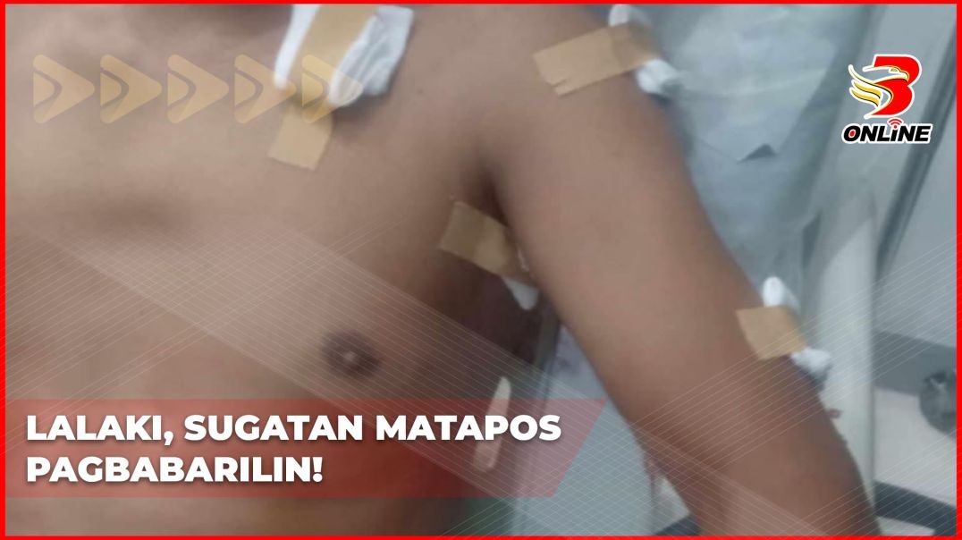 Lalaki, sugatan matapos pagbabarilin!