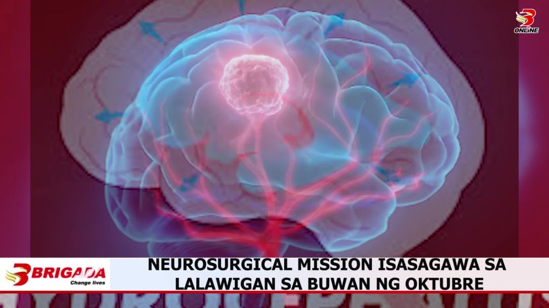 Neurosurgical mission isasagawa sa lalawigan sa buwan ng oktubre