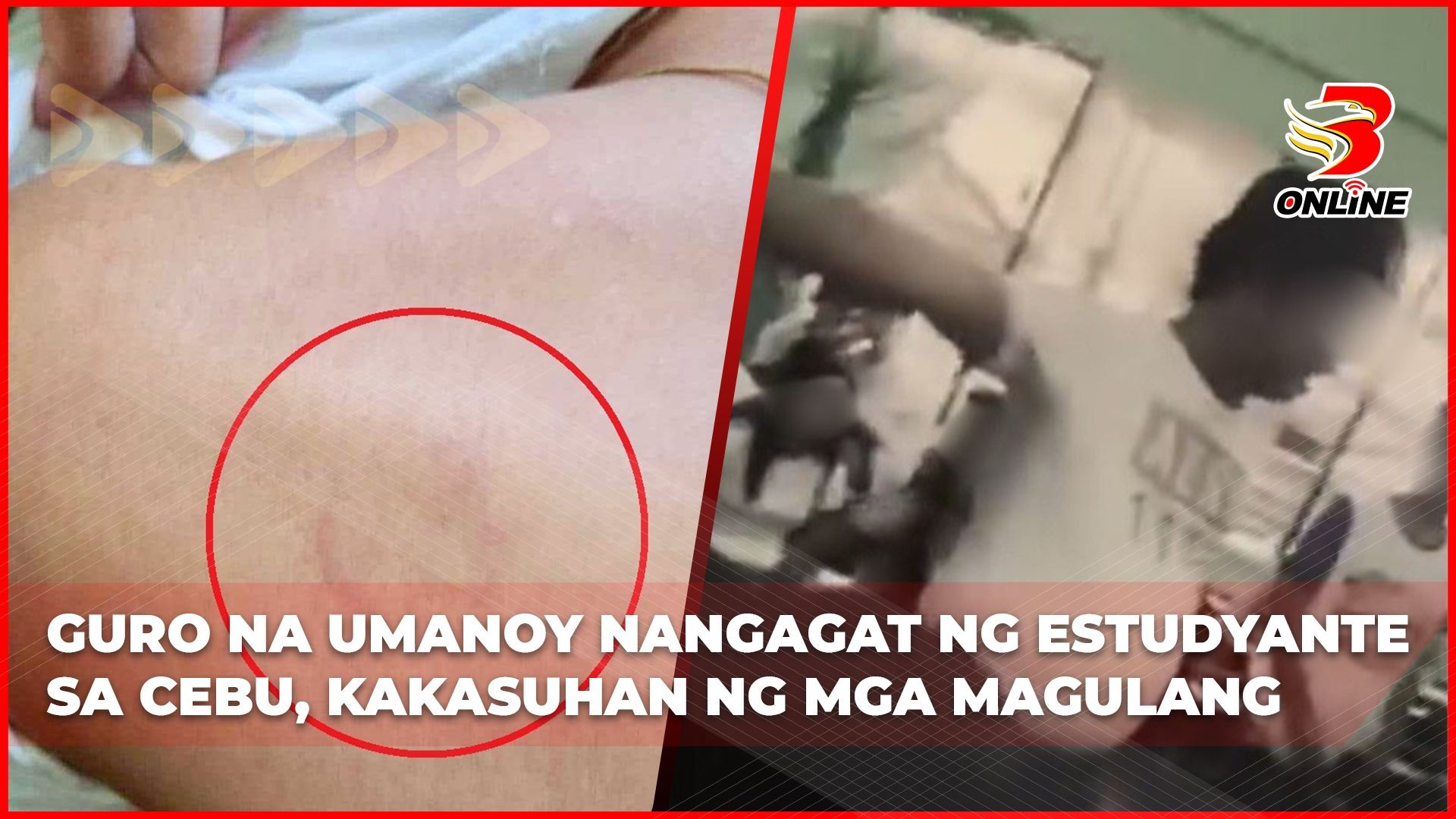 Guro na umanoy nangagat ng estudyante sa Cebu, kakasuhan ng mga magulang