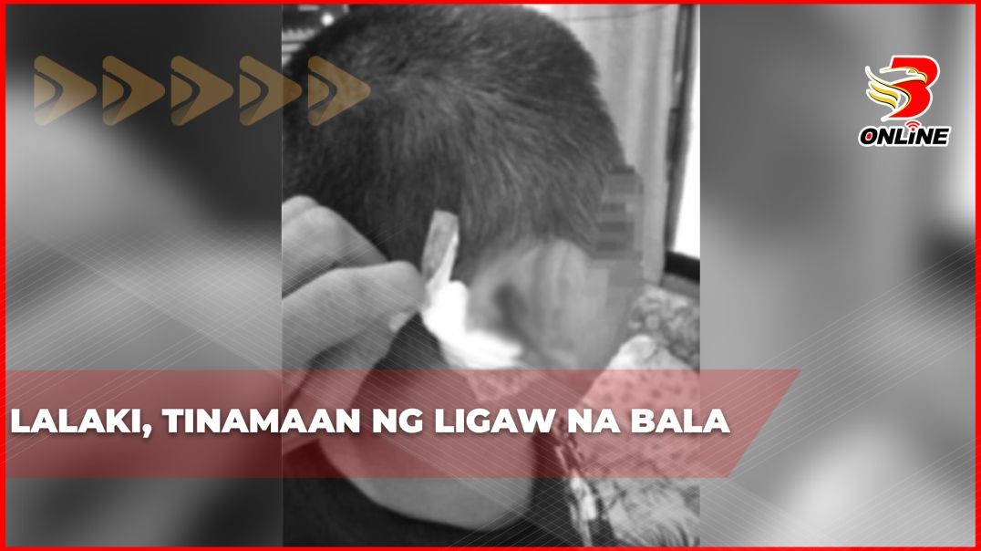Lalaki, tinamaan ng ligaw na bala