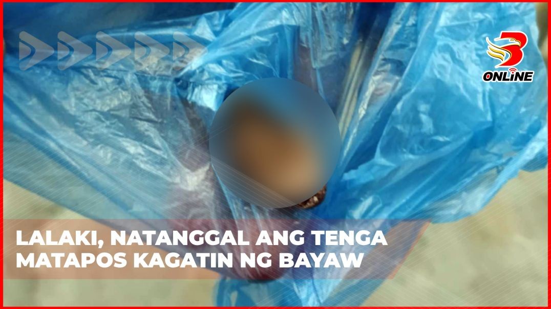 Lalaki, natanggal ang tenga matapos kagatin ng bayaw