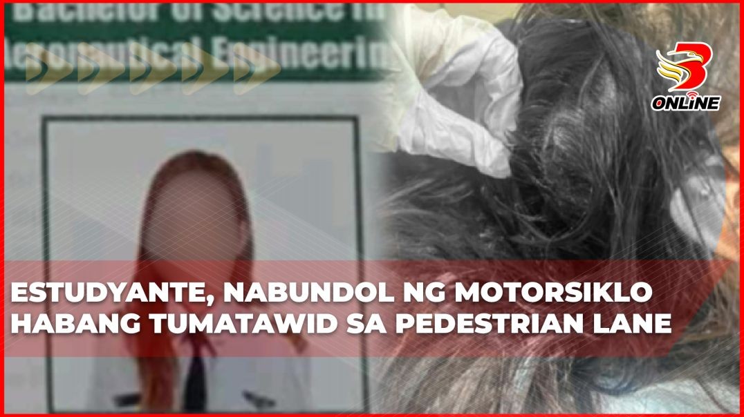 Estudyante, nabundol ng motorsiklo habang tumatawid sa pedestrian lane