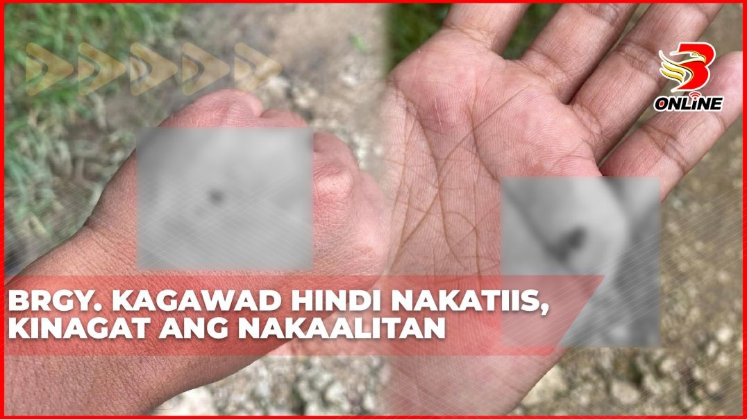 ⁣Brgy. Kagawad hindi nakatiis, kinagat ang nakaalitan