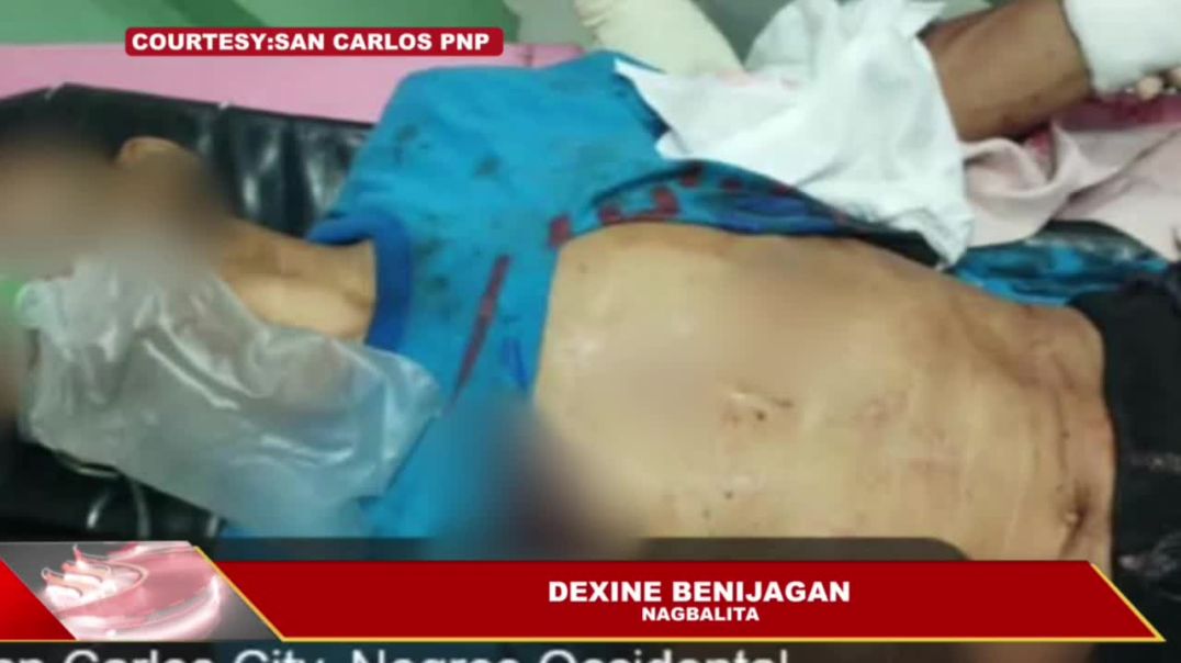PEDICAB DRIVER NGA NADUNGGABAN, LUWAS NA HUMAN NALANDIG SA TAMBALANAN